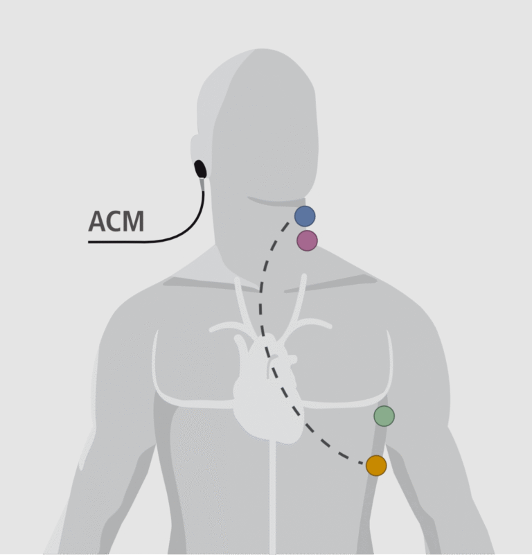Aperçu fonctionnement